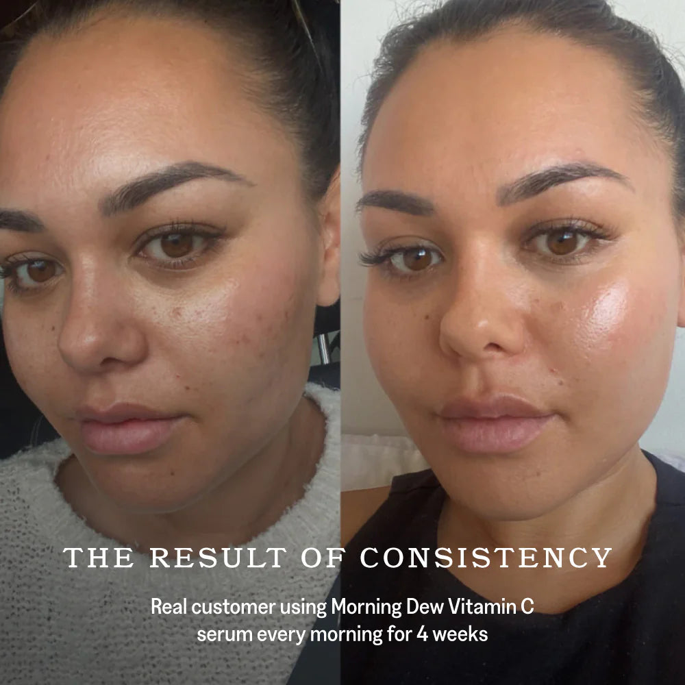 Raaie - Morning Dew Vitamin C Serum