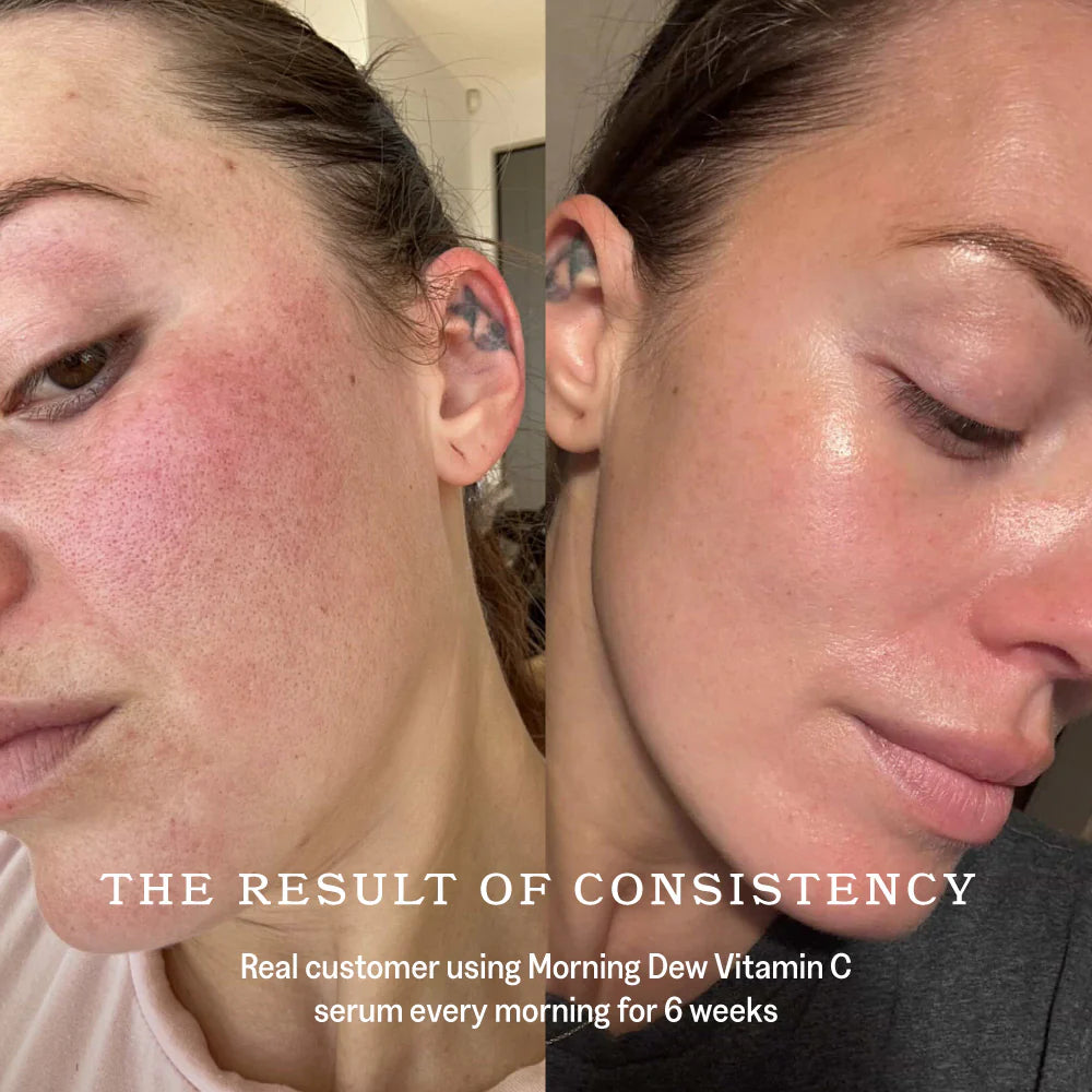 Raaie - Morning Dew Vitamin C Serum